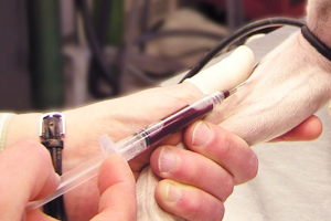 Xét Nghiệm Máu Cho Chó Mèo